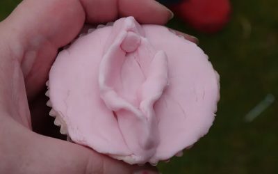 مراقبت های بعد از جراحی لابیاپلاستی