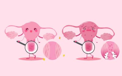 عفونت قارچی واژینال خطرناک است؟