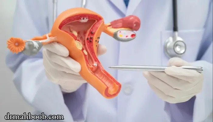 تنبلی تخمدان